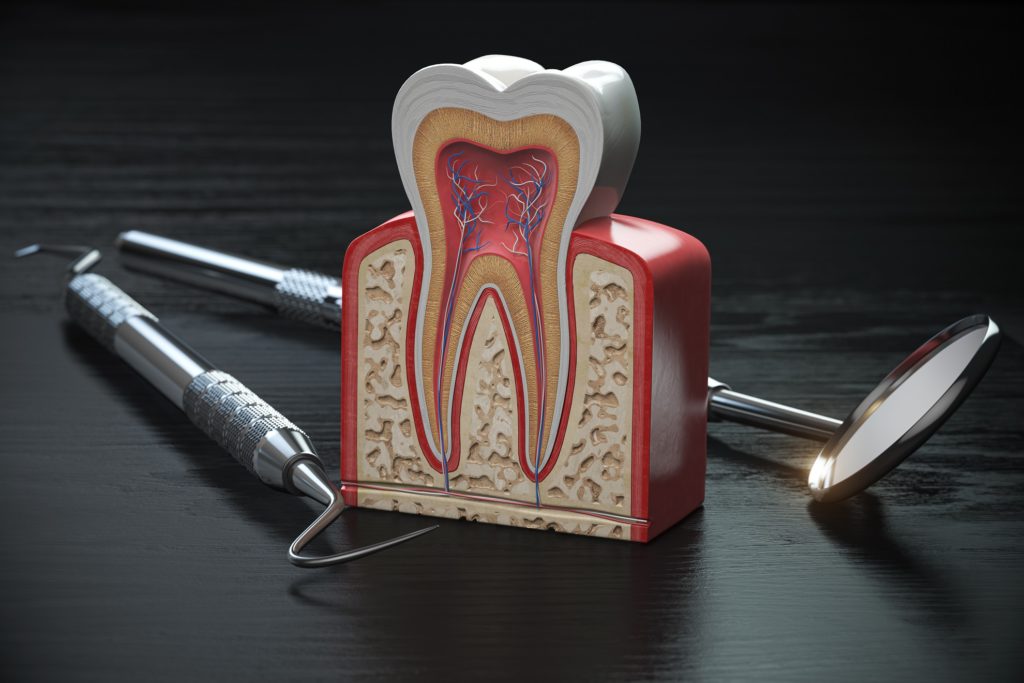 dental_implants_4_seasons_dental