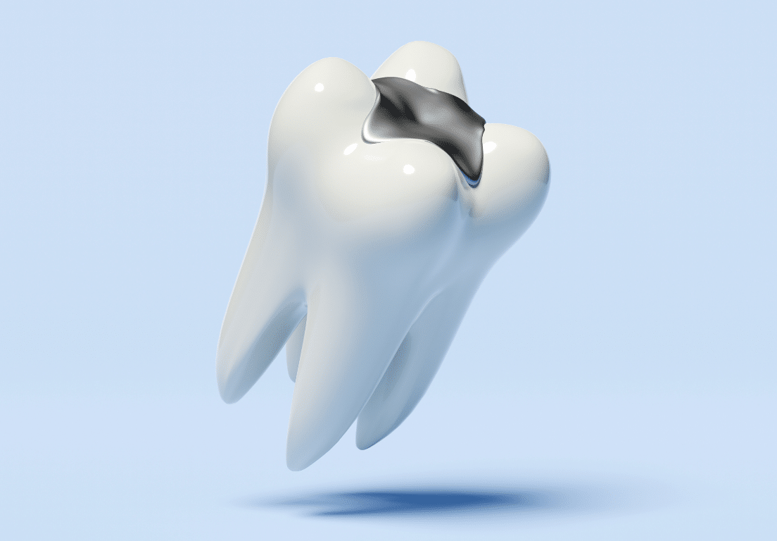 mercury_safe_dentistry_Milton-Freewater